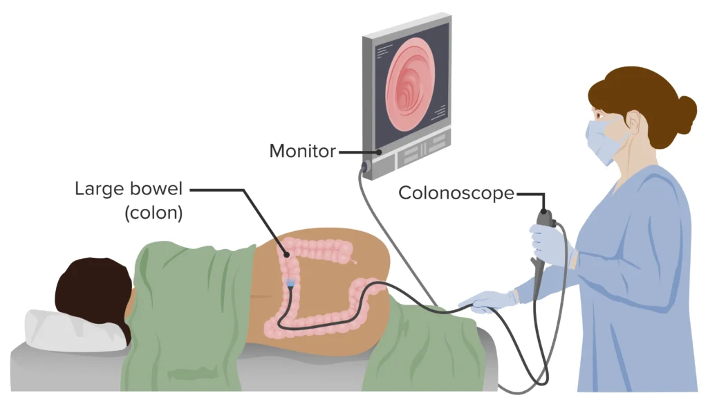 Colorectal cancer screening